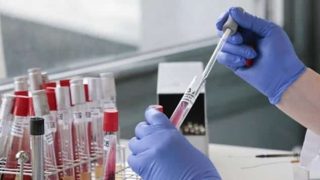 هل تدفع اثمنة التحليلات الطبية بسطات الى تنقيل هذه الخدمة الى البيضاء؟؟؟