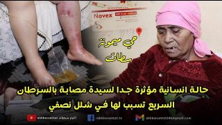 من حي ميمونة بسطات.. حالة انسانية مؤثرة جدا لسيدة مصابة بالسرطان السريع تسبب لها في شلل نصفي